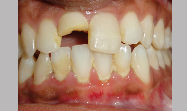 Best dentists in Anand                        